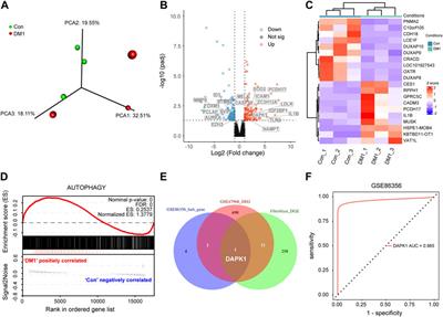 Identification of DAPK1 as an autophagy-related biomarker for myotonic dystrophy type 1